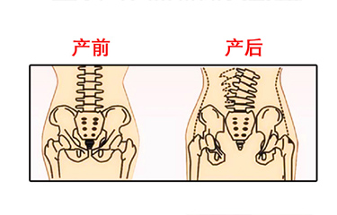 月子期間盆骨儀器修復時間有限制嗎？與手法修復相比哪個效果好？